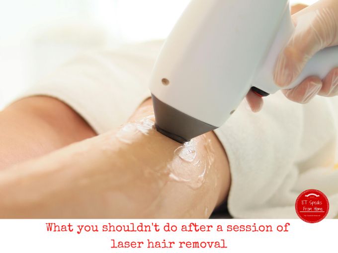 What you shouldn't do after a session of laser hair removal