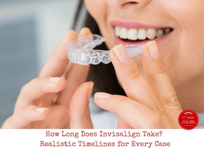 How Long Does Invisalign Take Realistic Timelines for Every Case